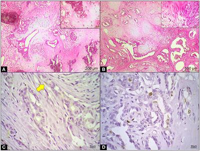 Hyperresistinemia in Obese Female Dogs With Mammary Carcinoma in Benign-Mixed Tumors and Its Correlation With Tumor Aggressiveness and Survival